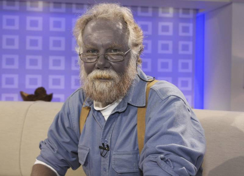 "Papa Smurf" swore by colloidal silver.